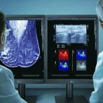 LG Electronics monitores de diagnóstico